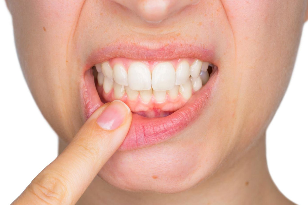 https://hornsby.dental/wp-content/uploads/2020/11/Gum-Disease-Treatment.jpg