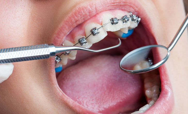 https://hornsby.dental/wp-content/uploads/2020/11/Orthodontic-Treatment-1.jpg