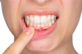 https://hornsby.dental/wp-content/uploads/2022/09/gum-treatment.jpg